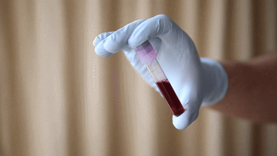 Blood Tests